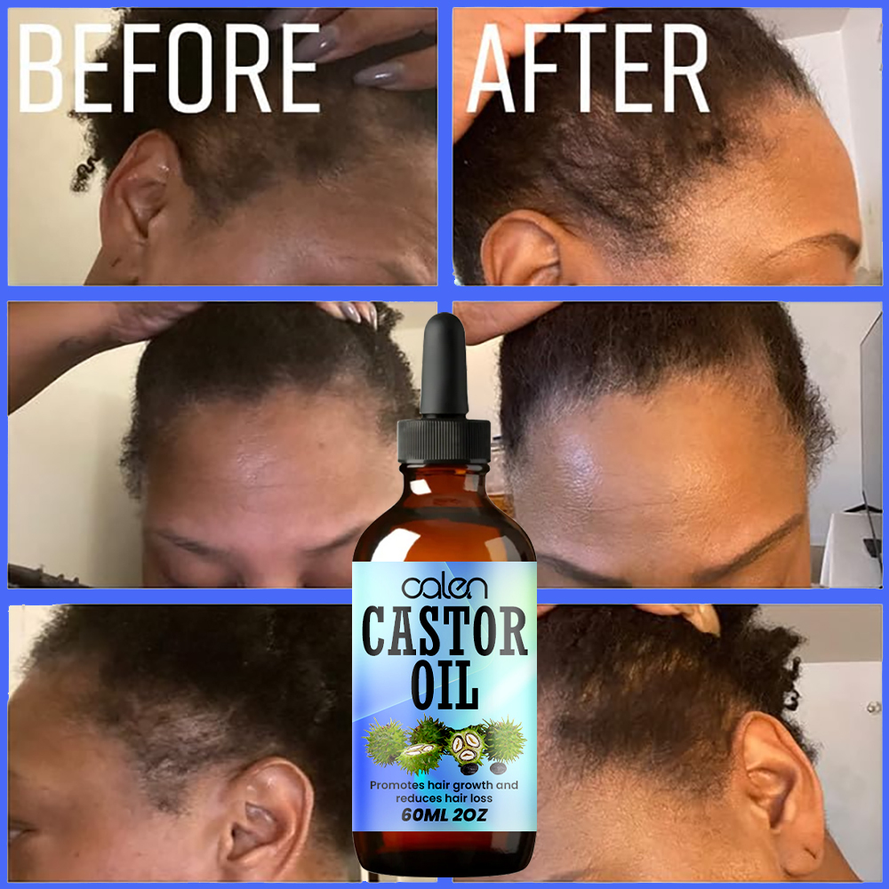 Luxfume Grows Thick Hair While Reducing Hair Loss Castor Oil,MY SHOP