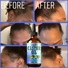 Luxfume Grows Thick Hair While Reducing Hair Loss Castor Oil,MY SHOP