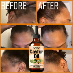 Luxfume Stimulates Hair, Eyelash, Eyebrow Growth Castor Oil,oalen cosmetics