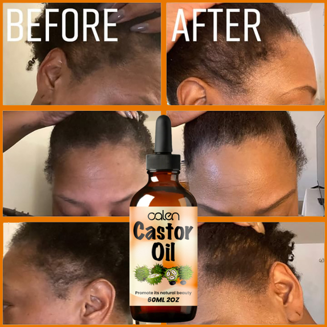 Luxfume Stimulates Hair, Eyelash, Eyebrow Growth Castor Oil,oalen cosmetics