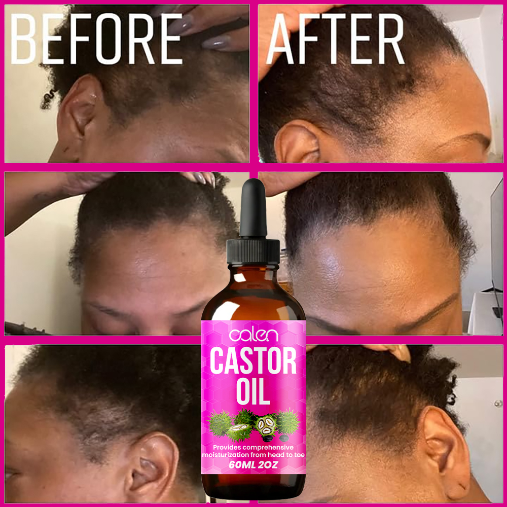 Luxfume Nourishes Skin, Promotes Hair Growth, Reduces Hair Loss,oalen cosmetics