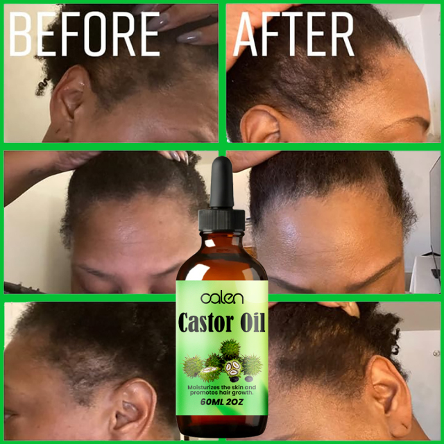 Luxfume Hair Strengthening Eyelash and Eyebrow Growth Serum Castor Oil,MY SHOP