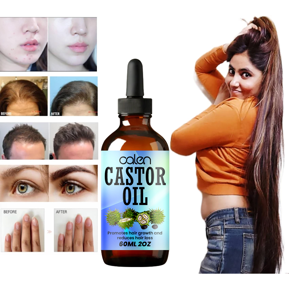 Luxfume Grows Thick Hair While Reducing Hair Loss Castor Oil,MY SHOP