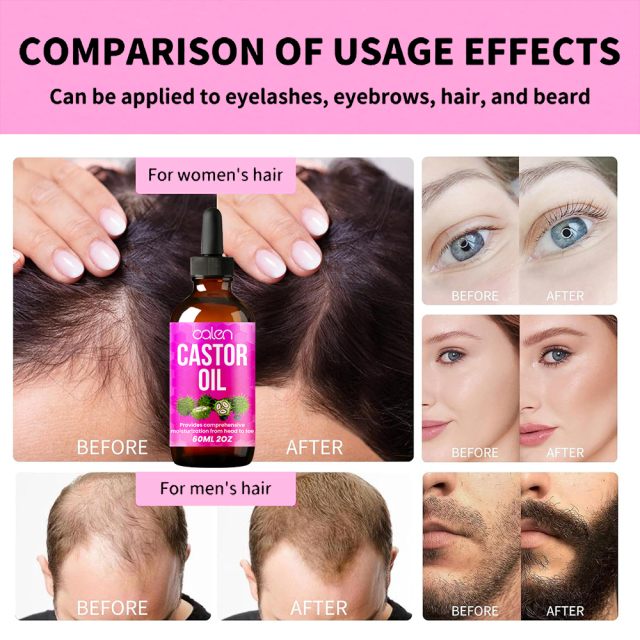 Luxfume 60Ml Moisturizing And Strong Hair Follicles Lock Moisturizing In The Hair Castor Oil,MY SHOP