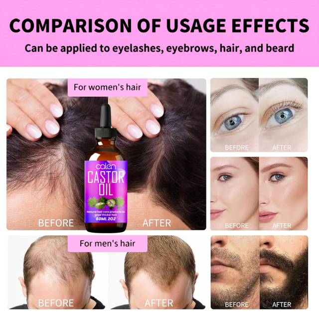 Luxfume 60Ml Help Hair Growth And Strong Recover Natural Shine To Hair Organic Castor Oil,MY SHOP