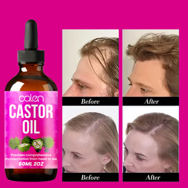 Luxfume 60Ml Moisturizing And Strong Hair Follicles Lock Moisturizing In The Hair Castor Oil,MY SHOP