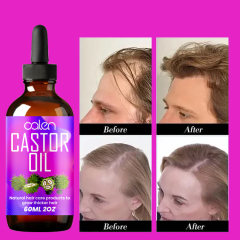Luxfume 60Ml Help Hair Growth And Strong Recover Natural Shine To Hair Organic Castor Oil,MY SHOP