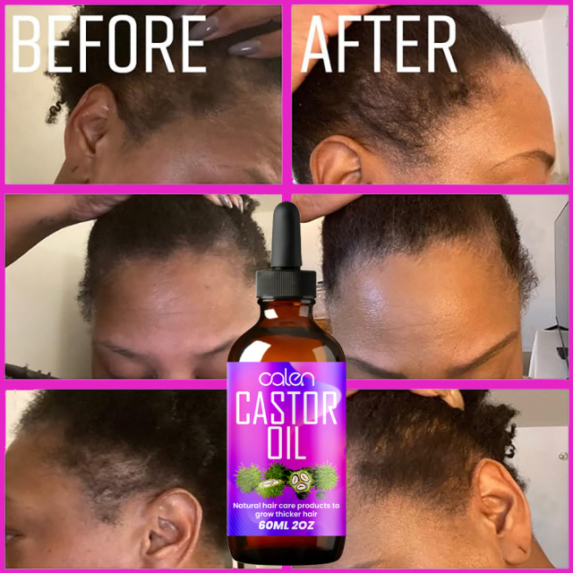 Luxfume 60Ml Help Hair Growth And Strong Recover Natural Shine To Hair Organic Castor Oil,MY SHOP