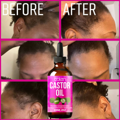 Luxfume 60Ml Moisturizing And Strong Hair Follicles Lock Moisturizing In The Hair Castor Oil,MY SHOP