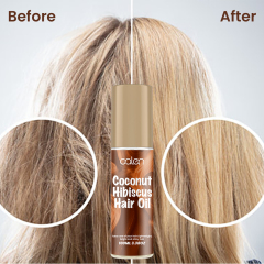 Luxfume 100ML relieves itching, removes dandruff, controls oil, makes hair soft and shiny black Hibiscus hair oil,MY SHOP