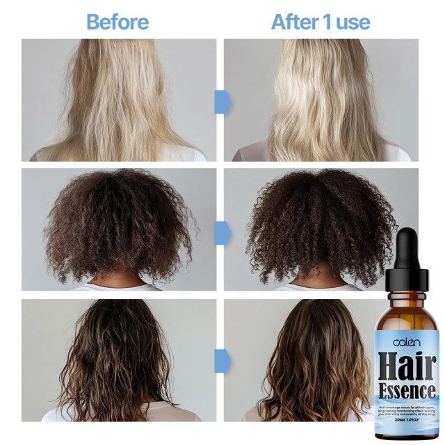 Strengthens hair growth, prevents hair loss and hair breakage conditioner,MY SHOP