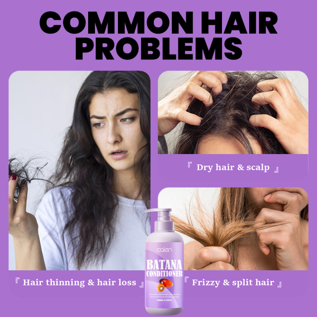 Reduce dryness and frizz, prevent hair fall batana conditioner,MY SHOP