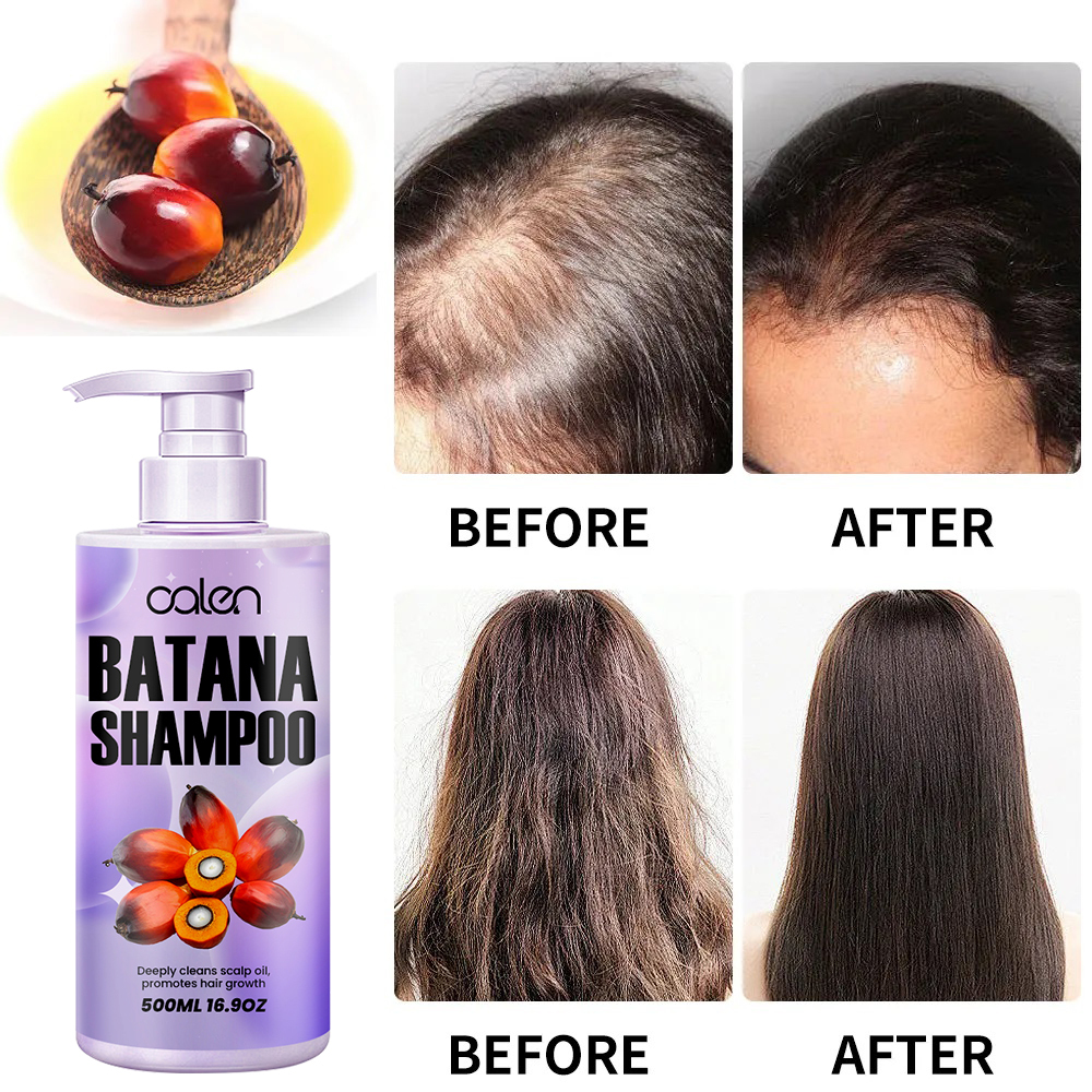 Relieves dry and itchy scalp, reduces hair breakage, promotes hair growth batana shampoo,oalen cosmetics