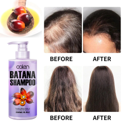 Relieves dry and itchy scalp, reduces hair breakage, promotes hair growth batana shampoo,oalen cosmetics