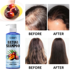 repairs damaged hair, promotes healthy hair growth, enhances natural luster, says goodbye to dry and dull hair batana shampoo,oalen cosmetics