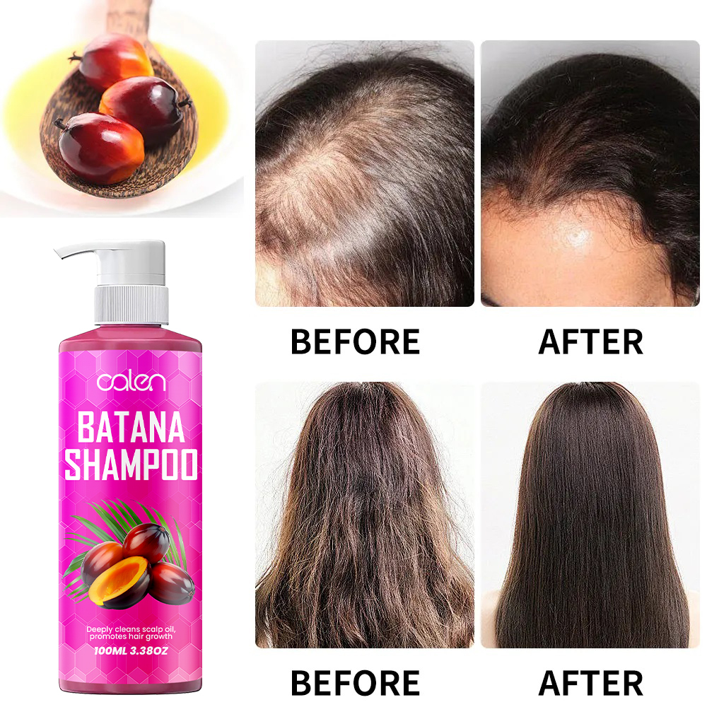 deeply nourishes and revitalizes hair, strengthens hair roots batana shampoo,MY SHOP
