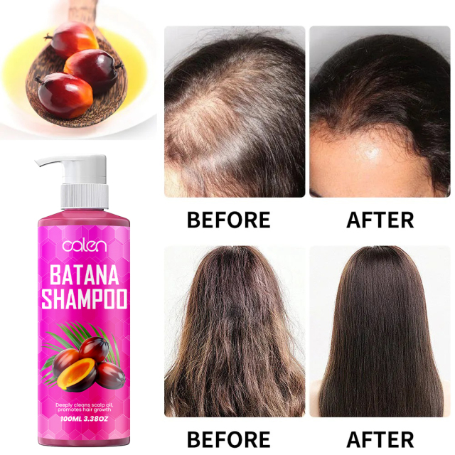 deeply nourishes and revitalizes hair, strengthens hair roots batana shampoo,MY SHOP
