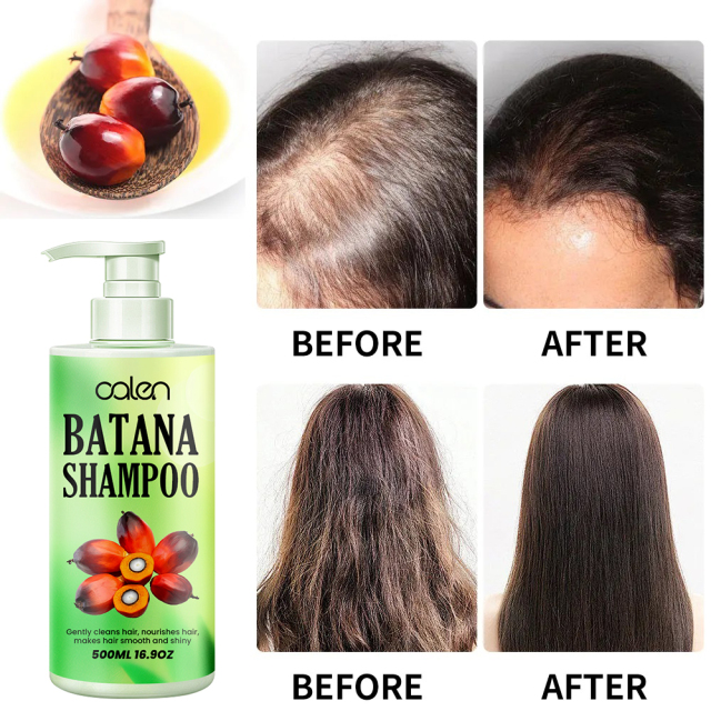 strengthens hair, removes dandruff, improves hair quality batana shampoo,MY SHOP
