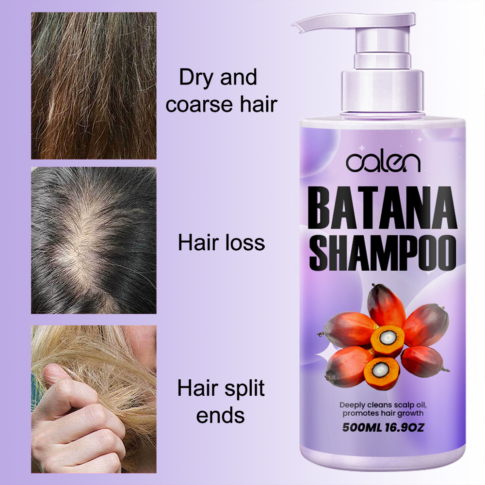 Relieves dry and itchy scalp, reduces hair breakage, promotes hair growth batana shampoo,oalen cosmetics