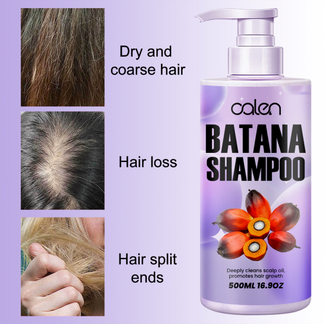 Relieves dry and itchy scalp, reduces hair breakage, promotes hair growth batana shampoo,oalen cosmetics