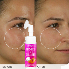 Moisturizing And Soften Skin Turmeric Cleanser Is Suitable For All Skin Type,oalen cosmetics