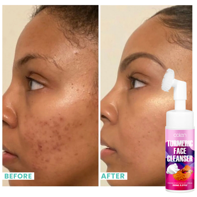 Gentle formula deep clean pore Promote healthy complexion Turmeric Cleanser,oalen cosmetics