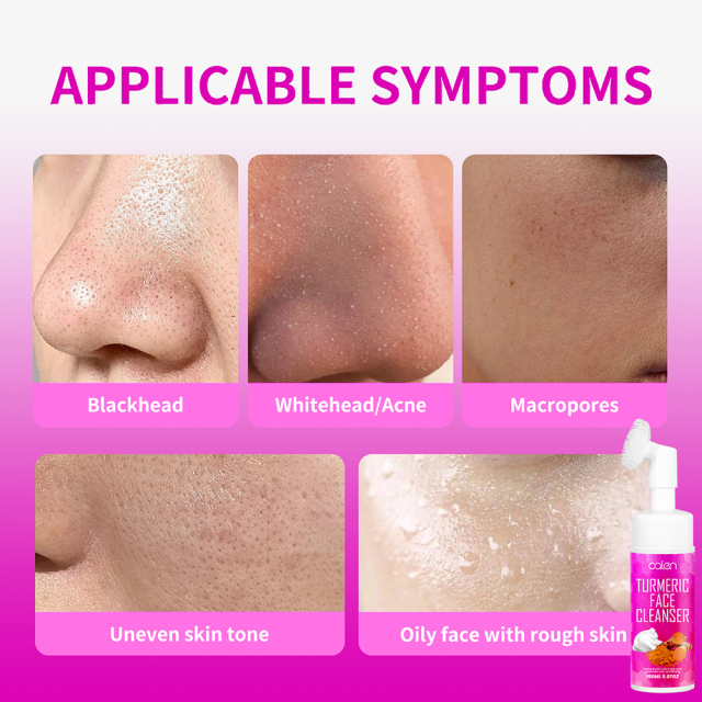 Moisturizing And Soften Skin Turmeric Cleanser Is Suitable For All Skin Type,oalen cosmetics