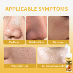 Clean Face Hydrate Dry Rough Skin Turmeric Cleanser,oalen cosmetics