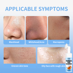 Deeply Clean Pores Removes Oil And Dirt Turmeric Cleanser,oalen cosmetics