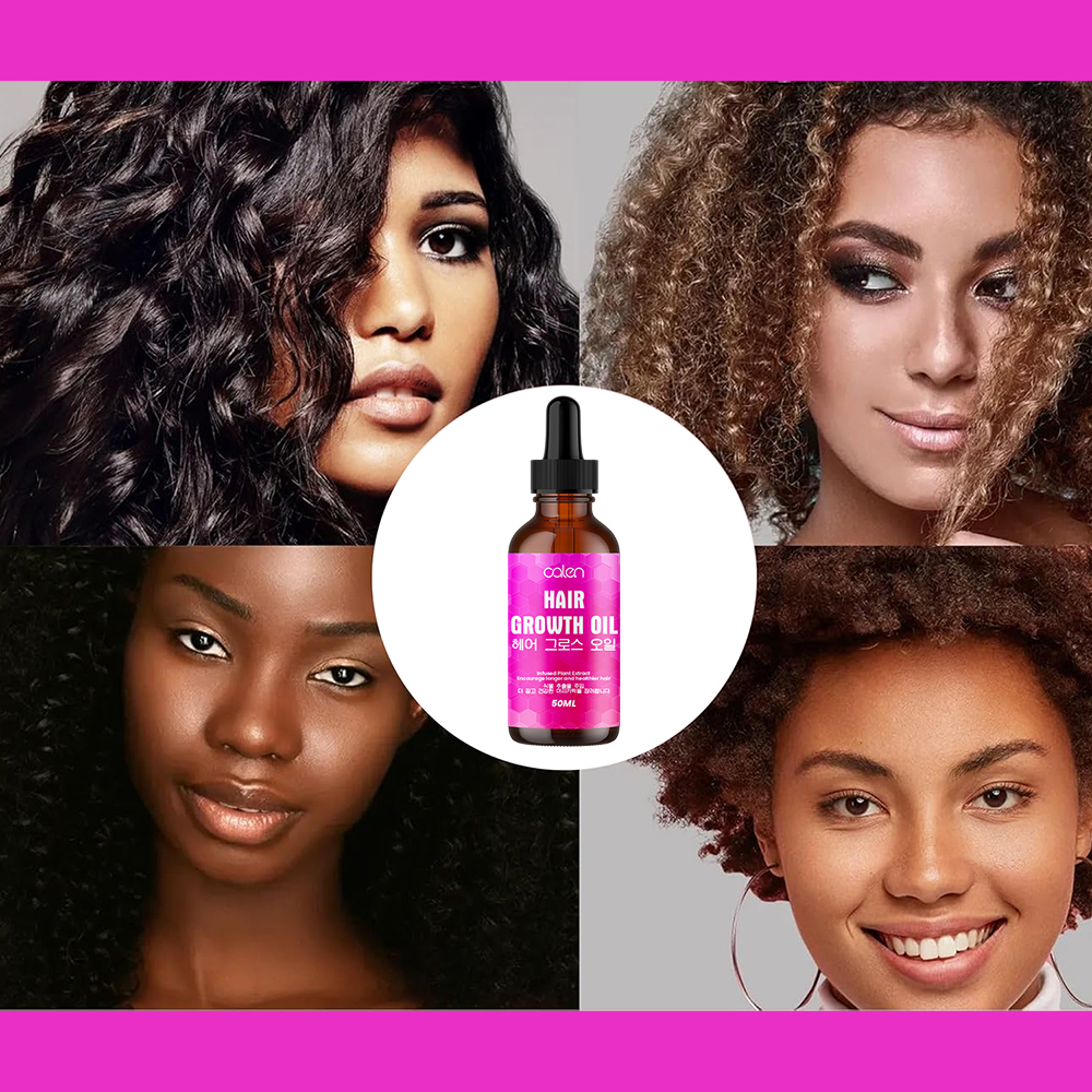 Luxfume 50ML Wholesale Original Plant Nourishing Hair Growth For Itchy & Dry Scalp Hair Care Oil,MY SHOP