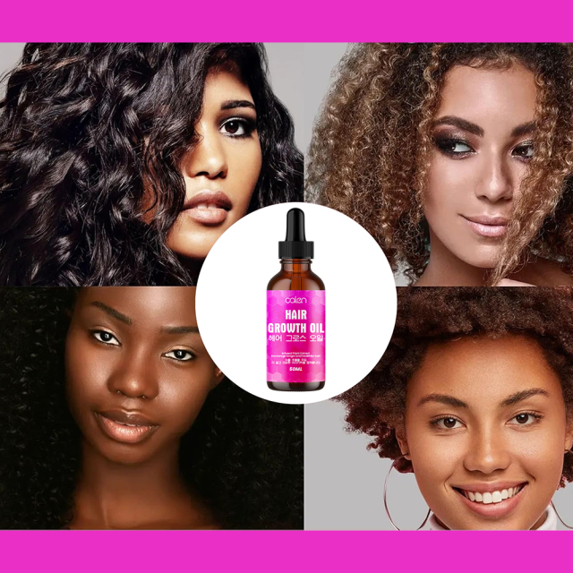 Luxfume 50ML Wholesale Original Plant Nourishing Hair Growth For Itchy & Dry Scalp Hair Care Oil,MY SHOP