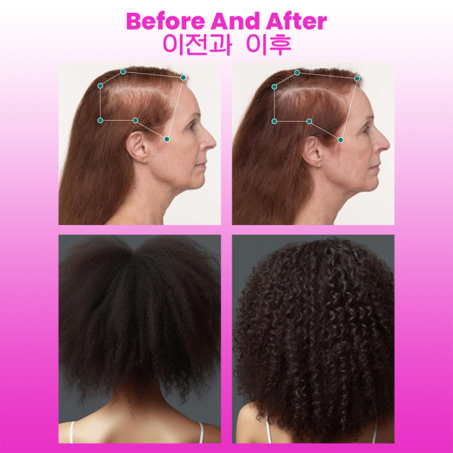 Luxfume 50ML Wholesale Original Plant Nourishing Hair Growth For Itchy & Dry Scalp Hair Care Oil,MY SHOP