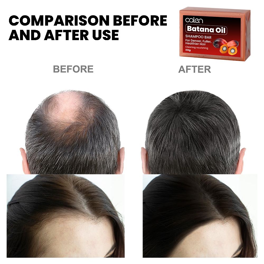 Can Batana Oil Really Help With Hair Growth?,oalen cosmetics