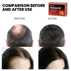 Can Batana Oil Really Help With Hair Growth?,oalen cosmetics