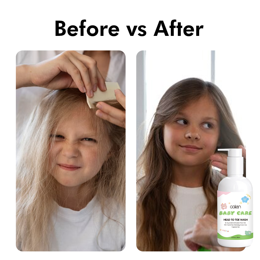 Private Label Herbal Hair Conditioner for Kids Nourishing and Hypoallergenic Smooth Soft Finish for Toddlers,MY SHOP