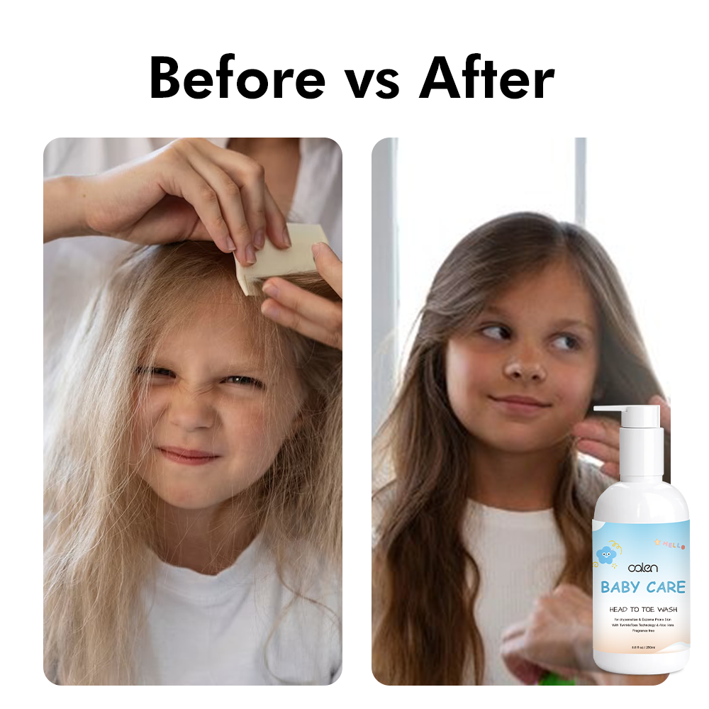 Gentle Tear-Free Kids Hair Care Set Shampoo and Conditioner Natural Hair Treatment for Children,MY SHOP