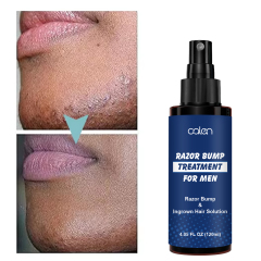 Razor Bumps Treatment for Men and Women After Shave Solution for Ingrown Hairs and Razor Burns Roll on Applicator,oalen cosmetics