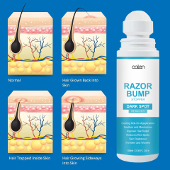 Razor Bump Stopper with Dark Spot Remover, Ingrown Hair Treatment for Bikini Area and Razor Bumps Treatment,MY SHOP