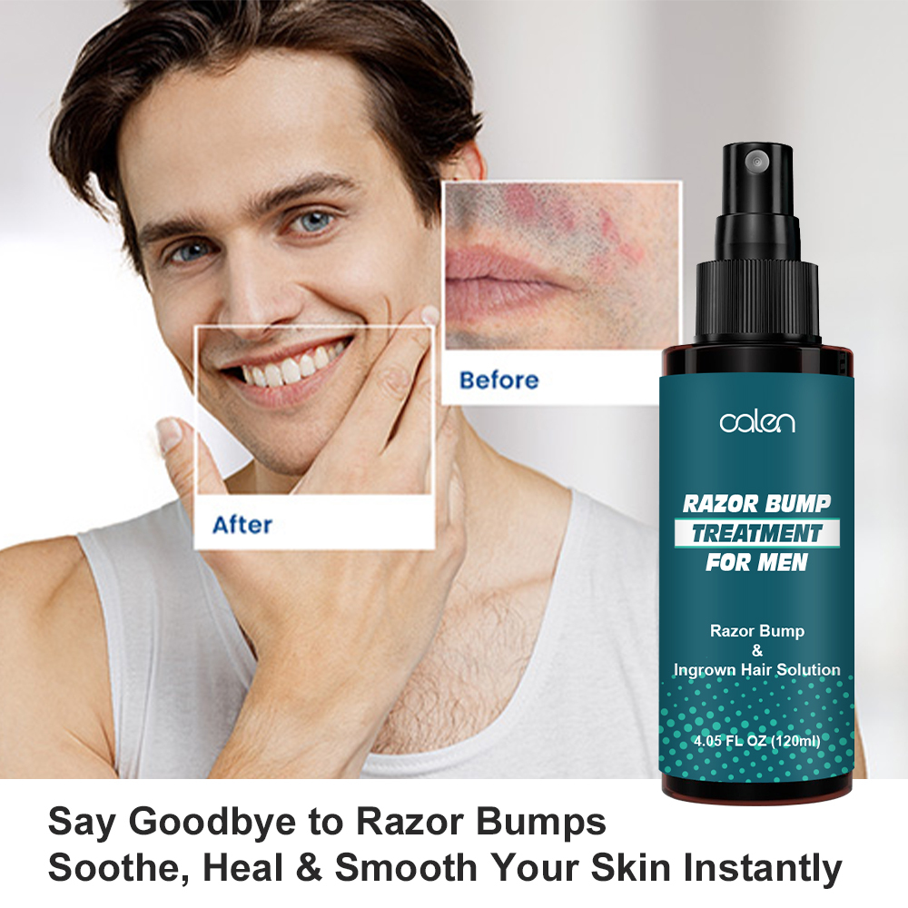 Razor Bump Stopper Ingrown Hair Treatment for Men & Women Razor Burn Relief for Bikini Area After Shave Lotion,oalen cosmetics