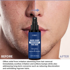 Razor Bumps Treatment for Men and Women After Shave Solution for Ingrown Hairs and Razor Burns Roll on Applicator,oalen cosmetics