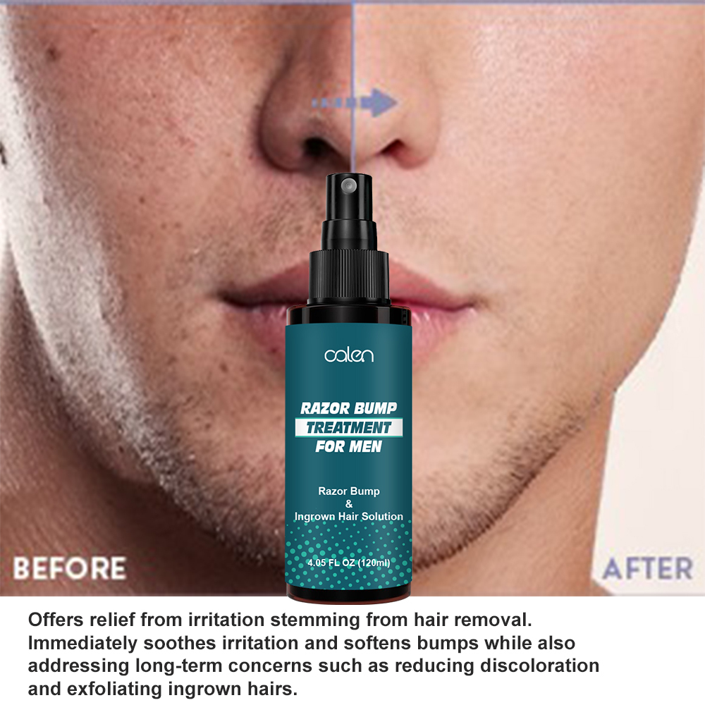Razor Bump Stopper Ingrown Hair Treatment for Men & Women Razor Burn Relief for Bikini Area After Shave Lotion,oalen cosmetics