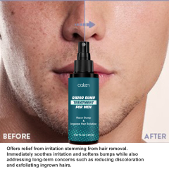 Razor Bump Stopper Ingrown Hair Treatment for Men & Women Razor Burn Relief for Bikini Area After Shave Lotion,oalen cosmetics