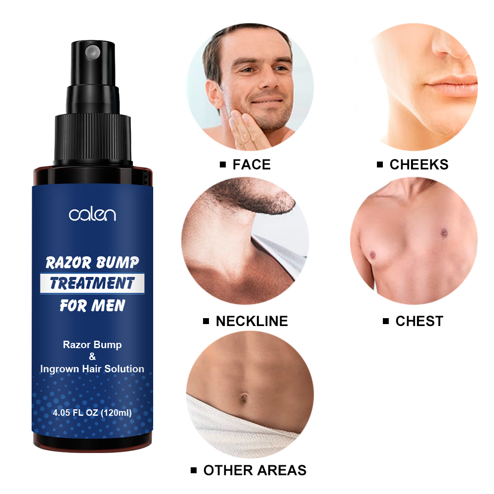 Razor Bumps Treatment for Men and Women After Shave Solution for Ingrown Hairs and Razor Burns Roll on Applicator,oalen cosmetics