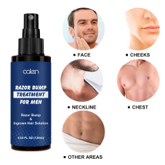 Razor Bumps Treatment for Men and Women After Shave Solution for Ingrown Hairs and Razor Burns Roll on Applicator,oalen cosmetics