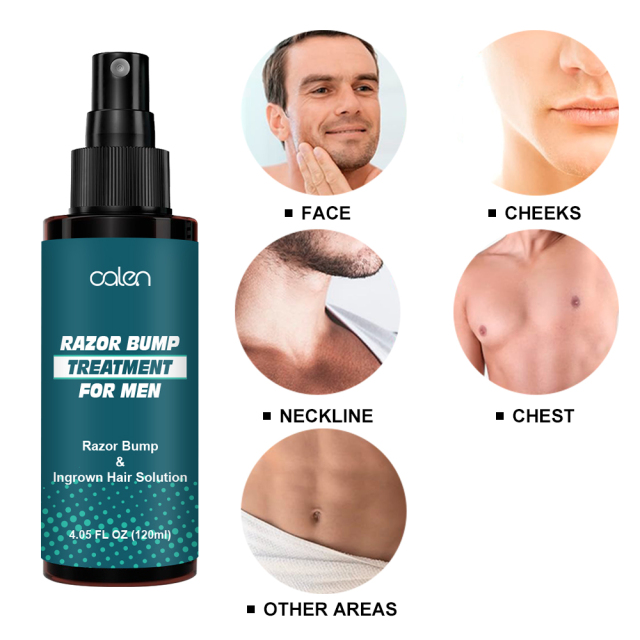 Razor Bump Stopper Ingrown Hair Treatment for Men & Women Razor Burn Relief for Bikini Area After Shave Lotion,oalen cosmetics