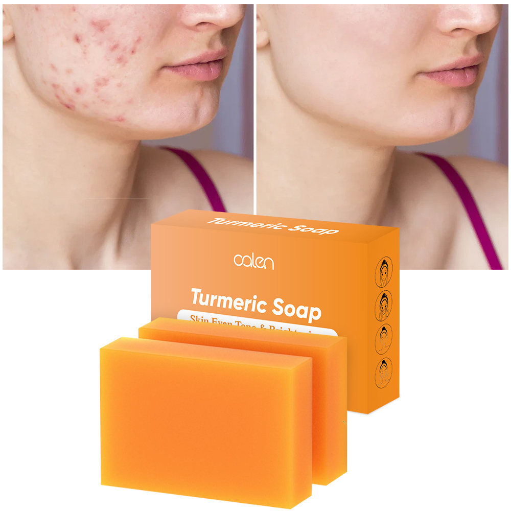 Lemon Turmeric Glowing Soap Natural Ingredients Dark Spot Remover Acne Treatment for Oily Dry Skin Moisturizing Face Body Care,MY SHOP