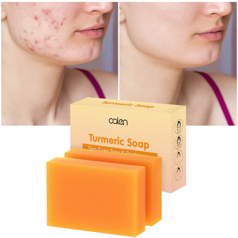 Kojic Acid Turmeric Soap Bar Dark Spot Remover for Face Even Skin Tone Moisturizing Nourishing Natural Ingredients,MY SHOP