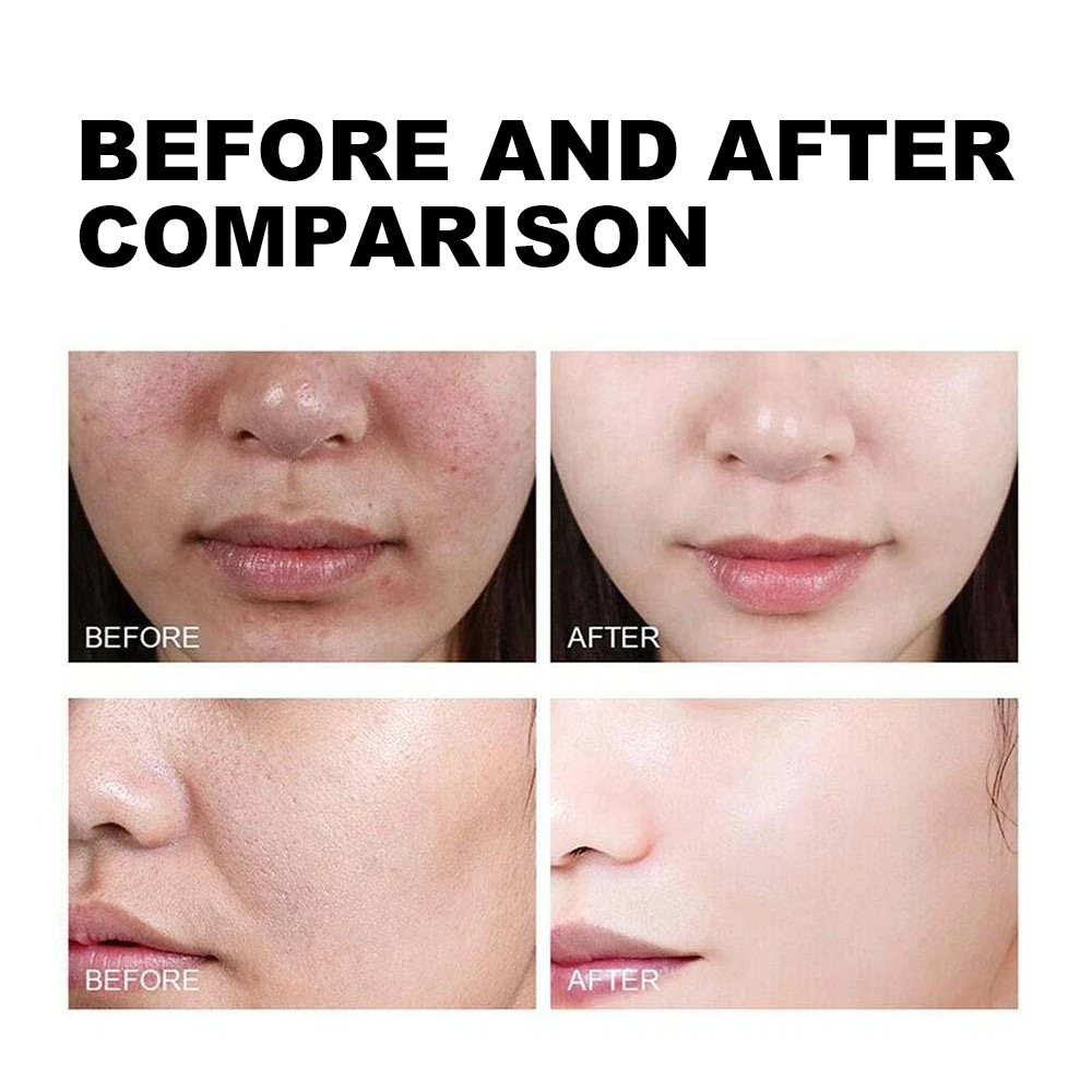 Luxfume Private Label Exfoliating Black Rice Serum Smooth and Glowing Skin Care Peel Off Serum,oalen cosmetics