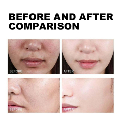 Luxfume Private Label Exfoliating Black Rice Serum Smooth and Glowing Skin Care Peel Off Serum,oalen cosmetics
