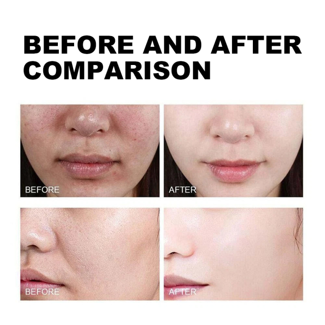 Luxfume Private Label Exfoliating Black Rice Serum Smooth and Glowing Skin Care Peel Off Serum,oalen cosmetics